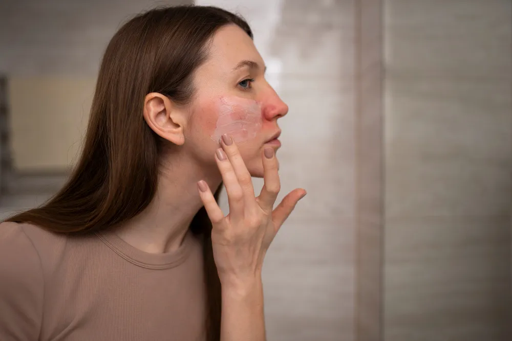 Understanding Rosacea: Causes, Symptoms, and Treatment