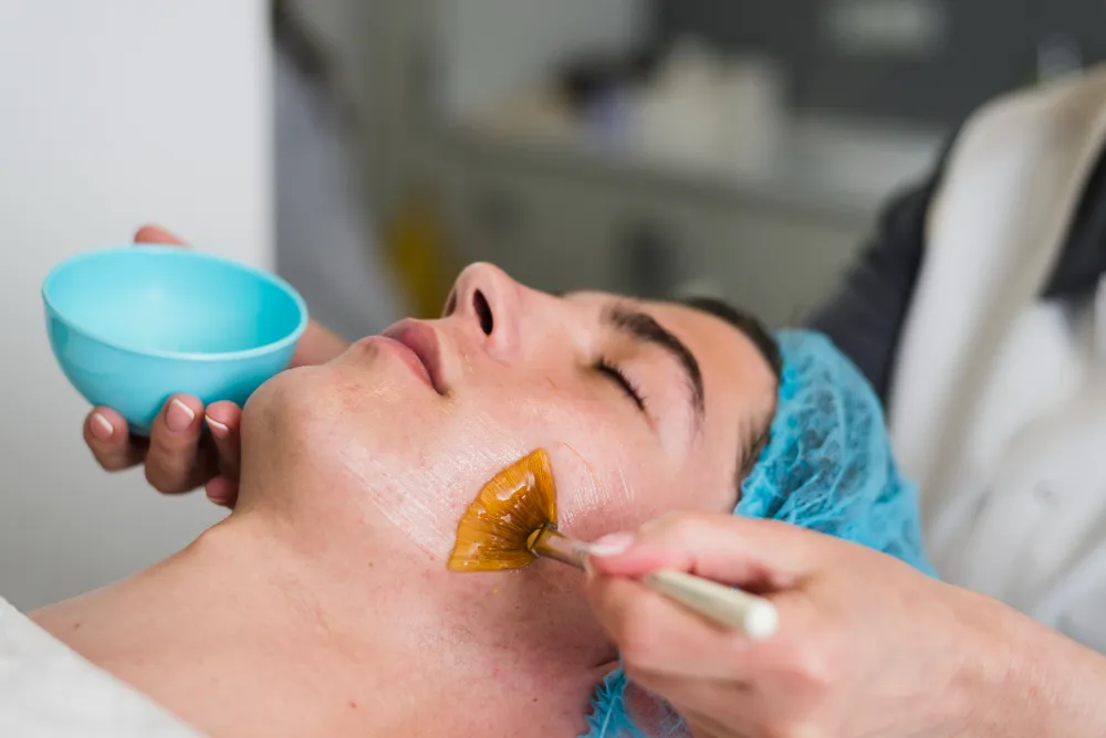 The Benefits of Chemical Peels for Skin Rejuvenation
