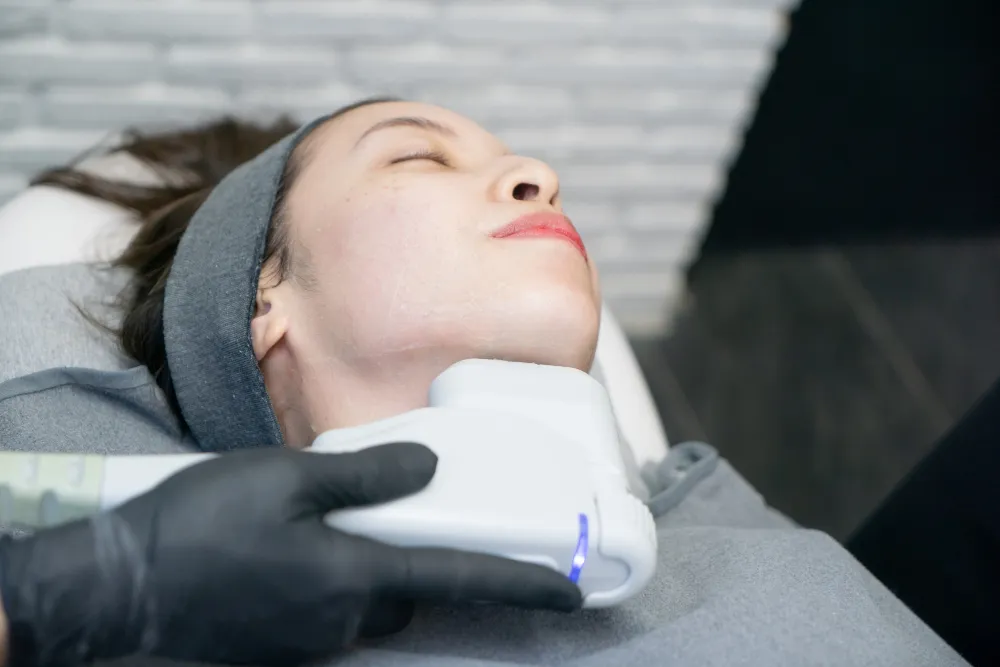 Chin Laser Hair Removal