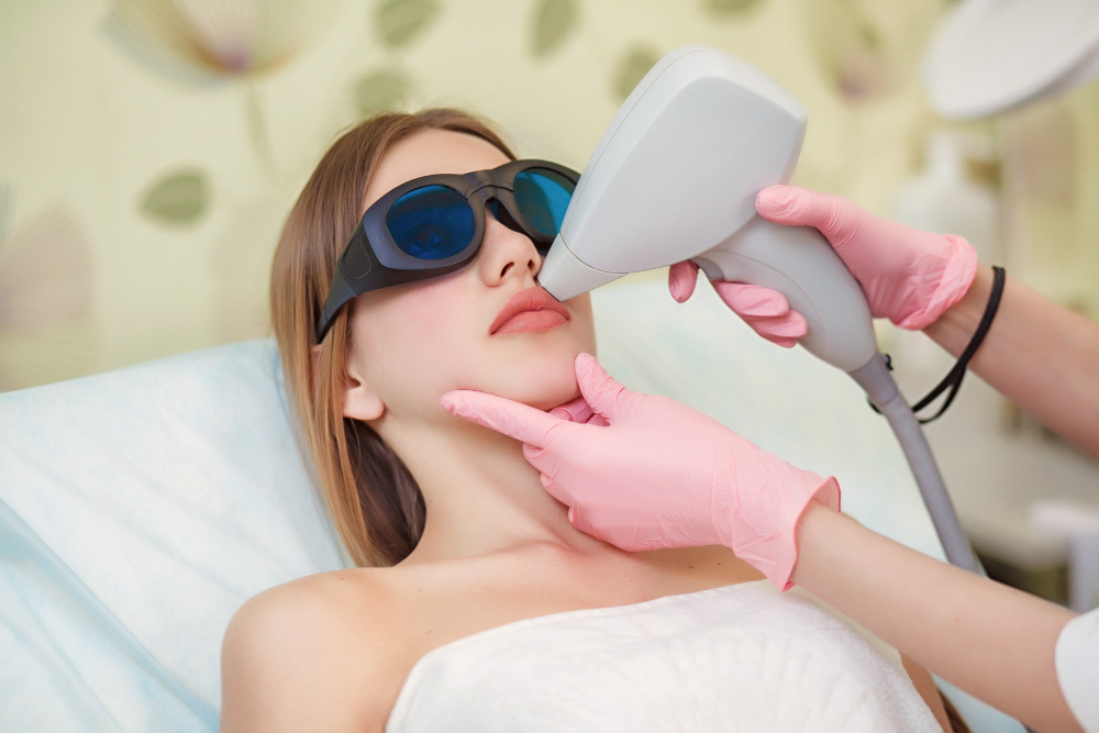 upperlip-laser-hair-removal